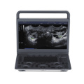 Новый усовершенствованный соноскап E1 Exp Portable Color Doppler Ultrasound для человека